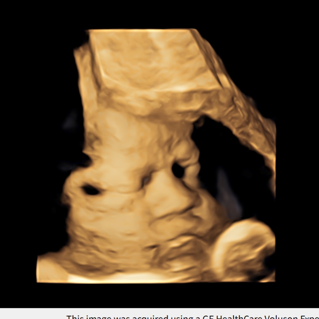 Photo shared by Paulina for their Babylist baby registry.