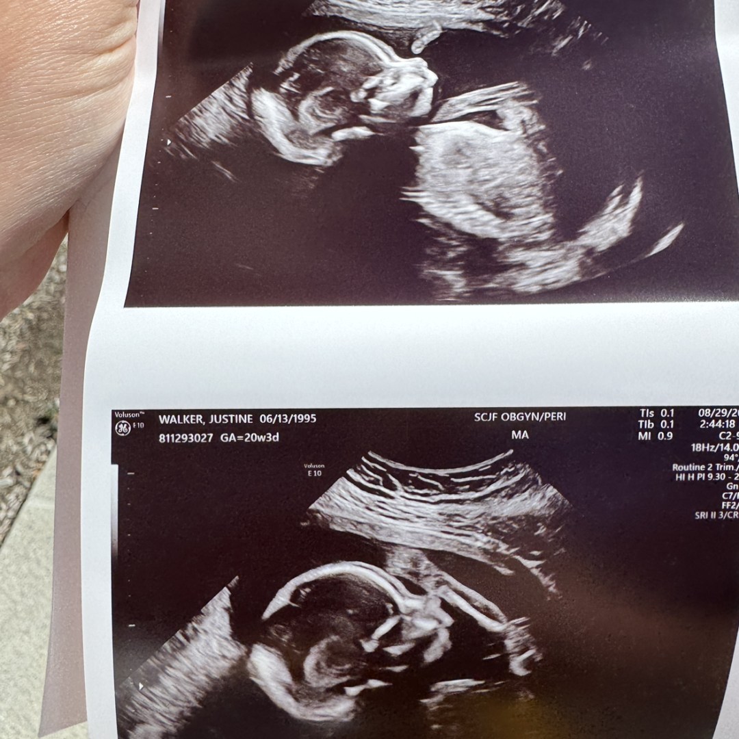 Photo shared by Justine for their Babylist baby registry.