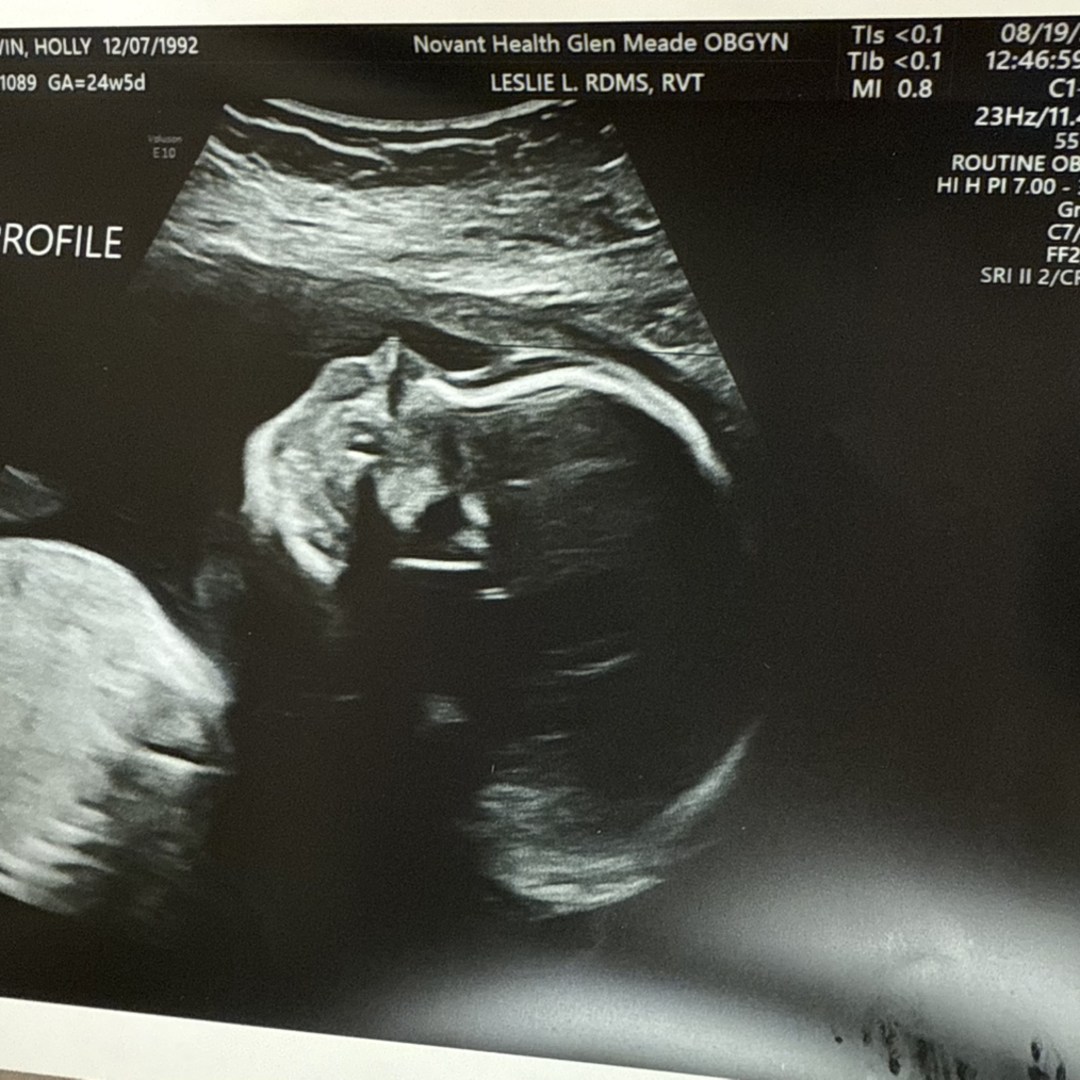 Photo shared by Holly for their Babylist baby registry.