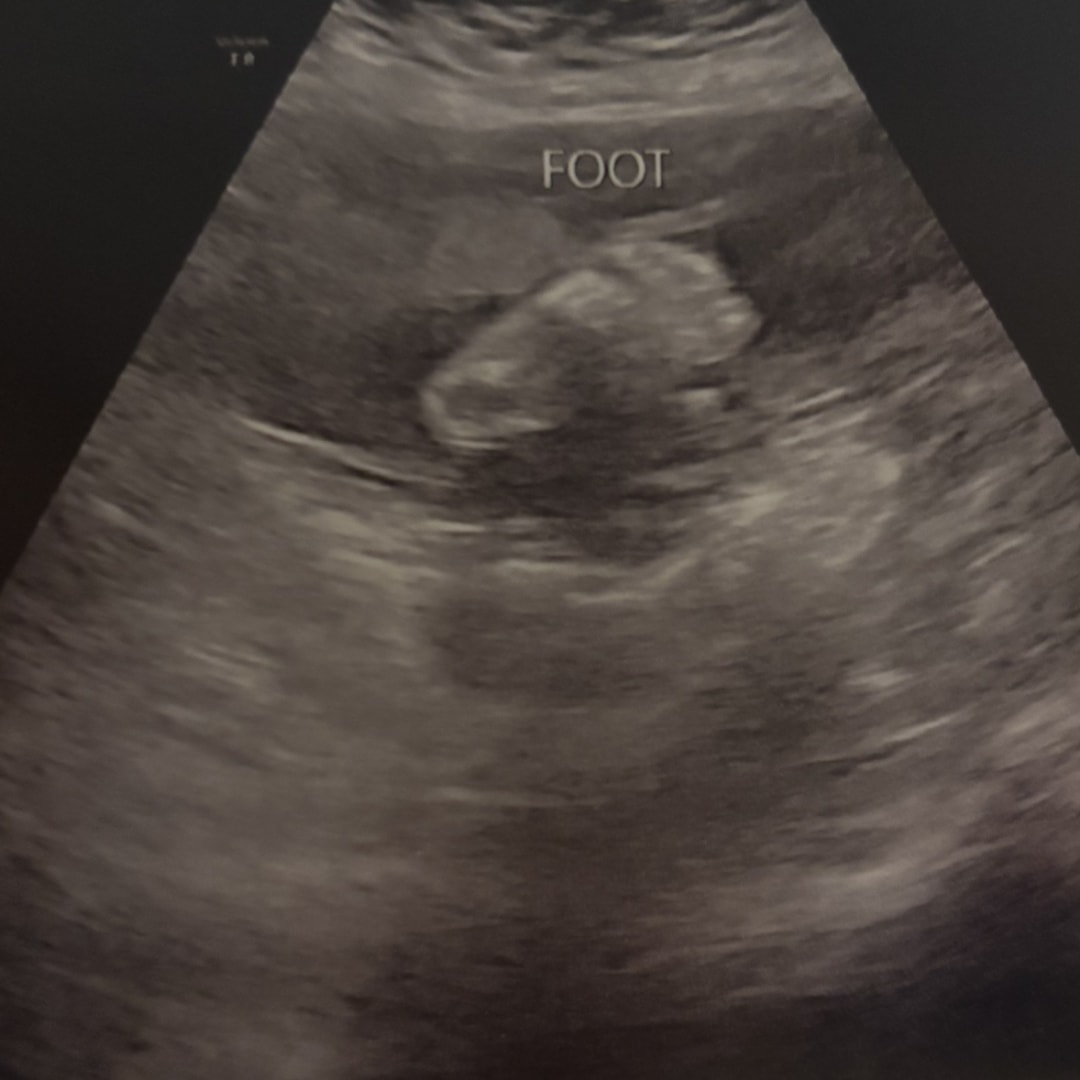 Photo shared by Denize for their Babylist baby registry.