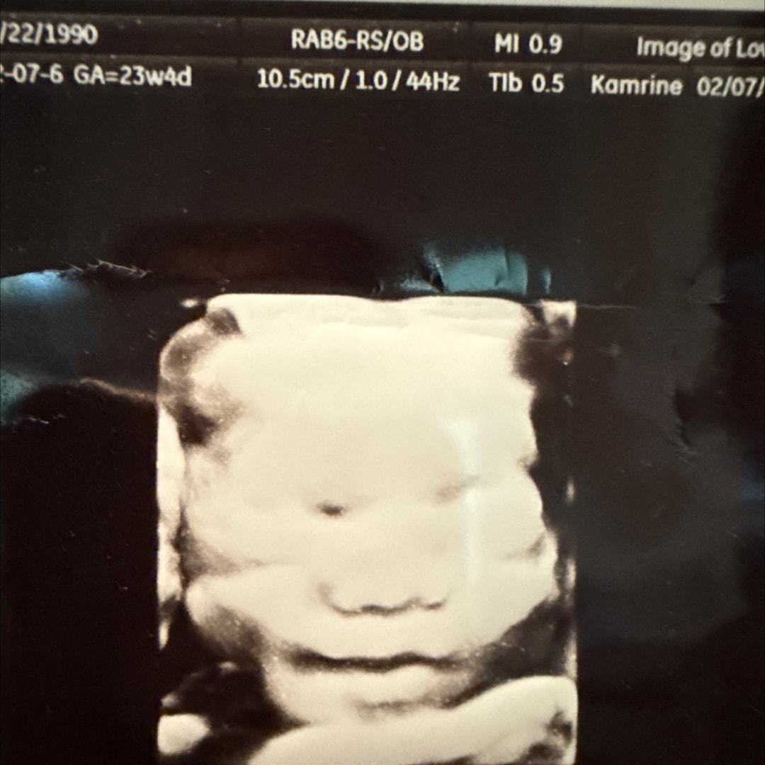 Photo shared by Cece for their Babylist baby registry.