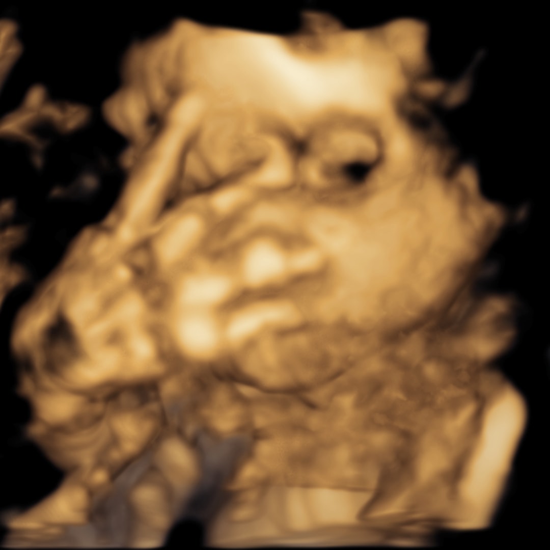 Photo shared by Lillian for their Babylist baby registry.