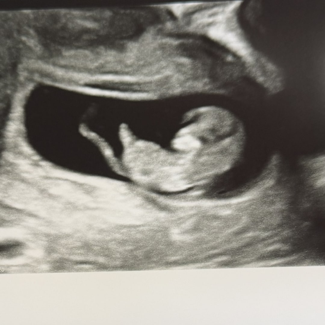 Photo shared by Aliyah for their Babylist baby registry.