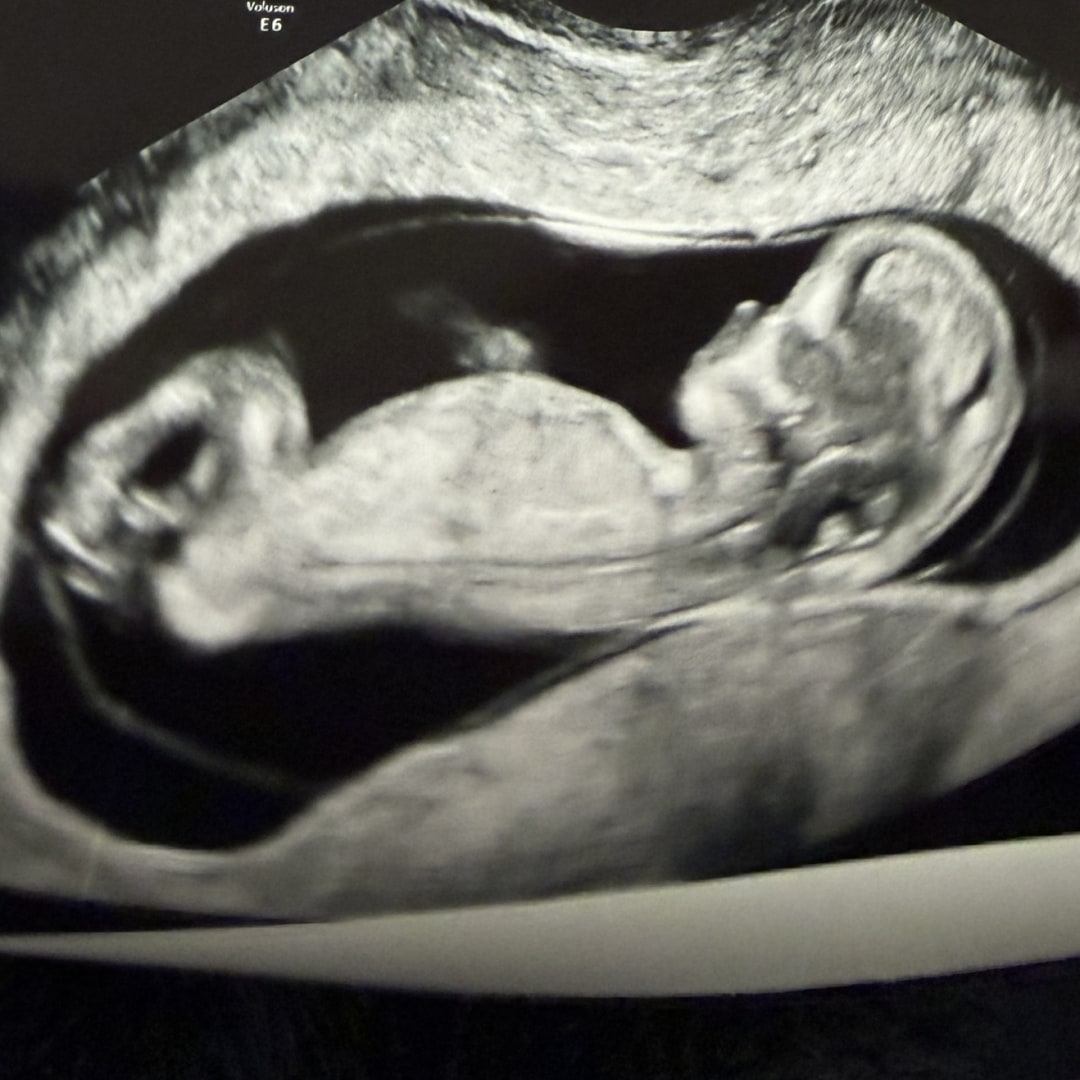 Photo shared by Alyssa for their Babylist baby registry.