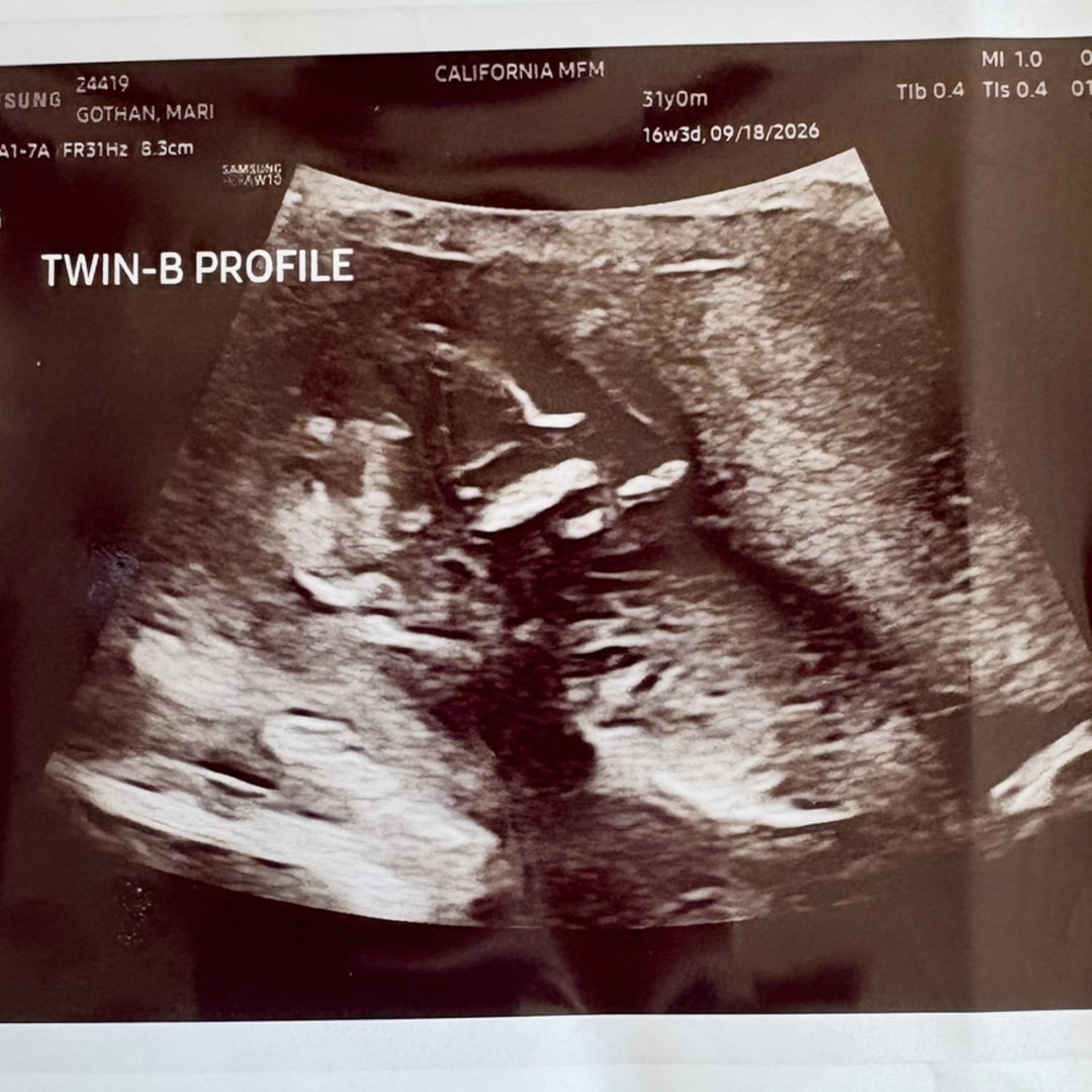 Photo shared by Mari for their Babylist baby registry.