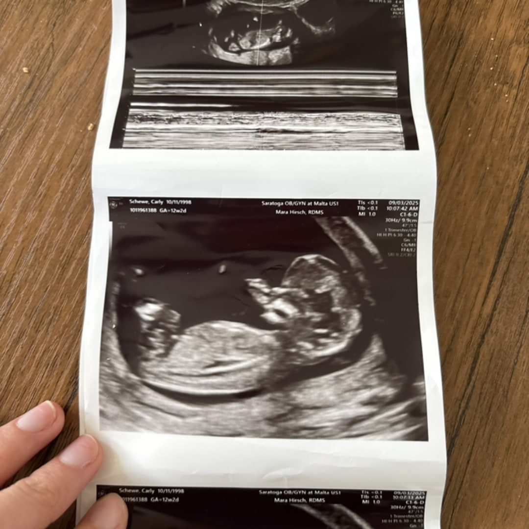 Photo shared by Carly for their Babylist baby registry.