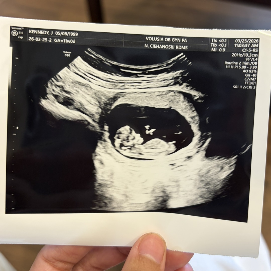 Photo shared by Jaqueline for their Babylist baby registry.