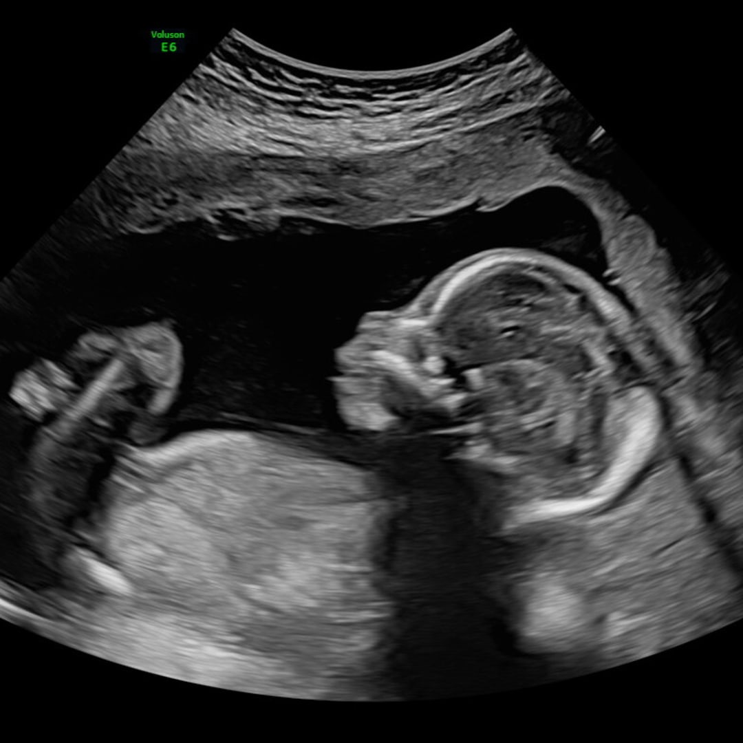 Photo shared by Addison for their Babylist baby registry.