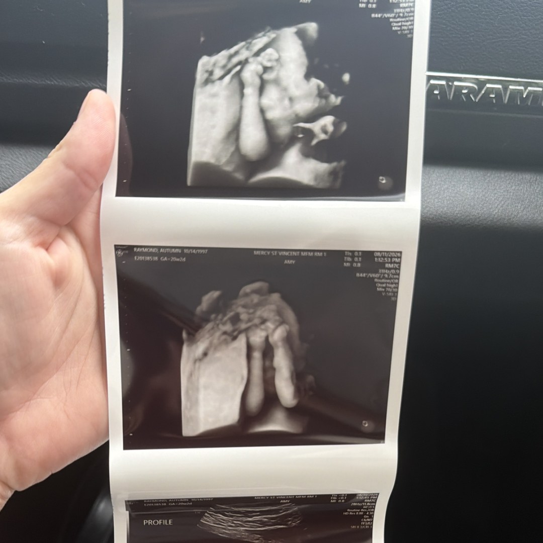 Photo shared by Autumn for their Babylist baby registry.