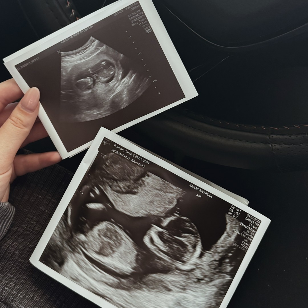 Photo shared by Sarah for their Babylist baby registry.