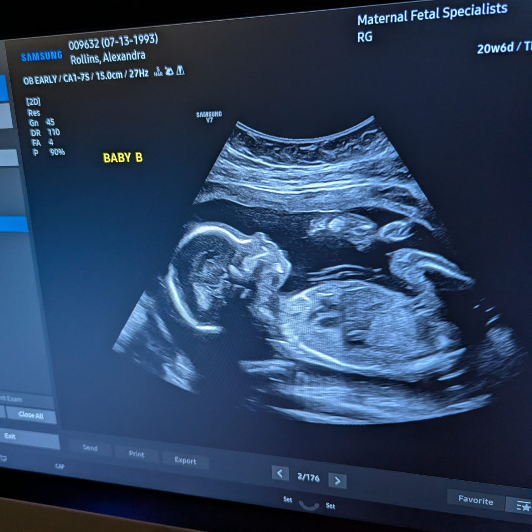 Photo shared by Alexandra for their Babylist baby registry.