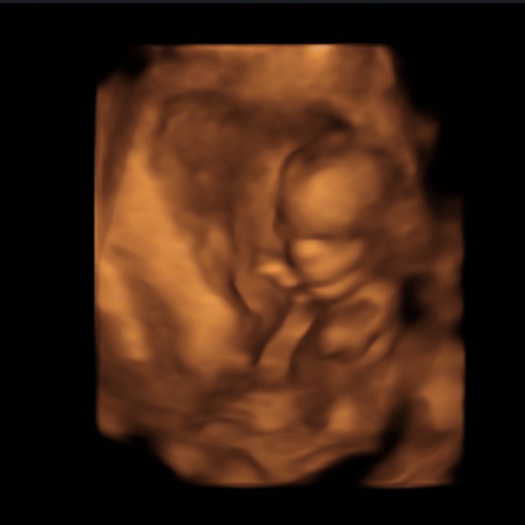 Photo shared by Alyssa for their Babylist baby registry.