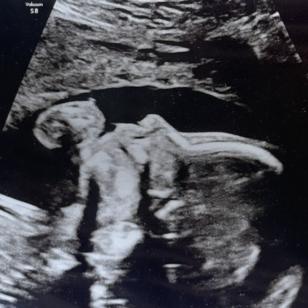 Photo shared by Ifet for their Babylist baby registry.