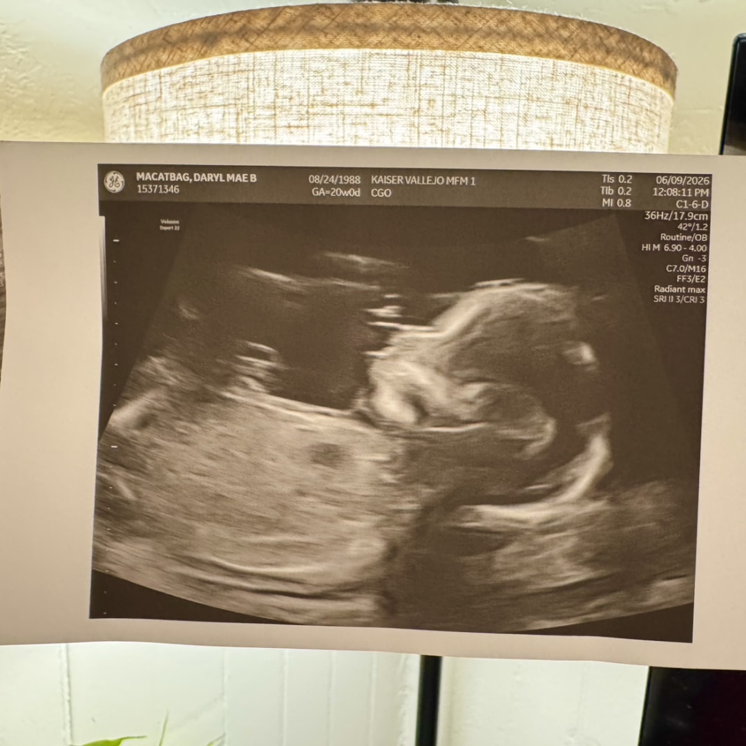 Photo shared by Mae & for their Babylist baby registry.