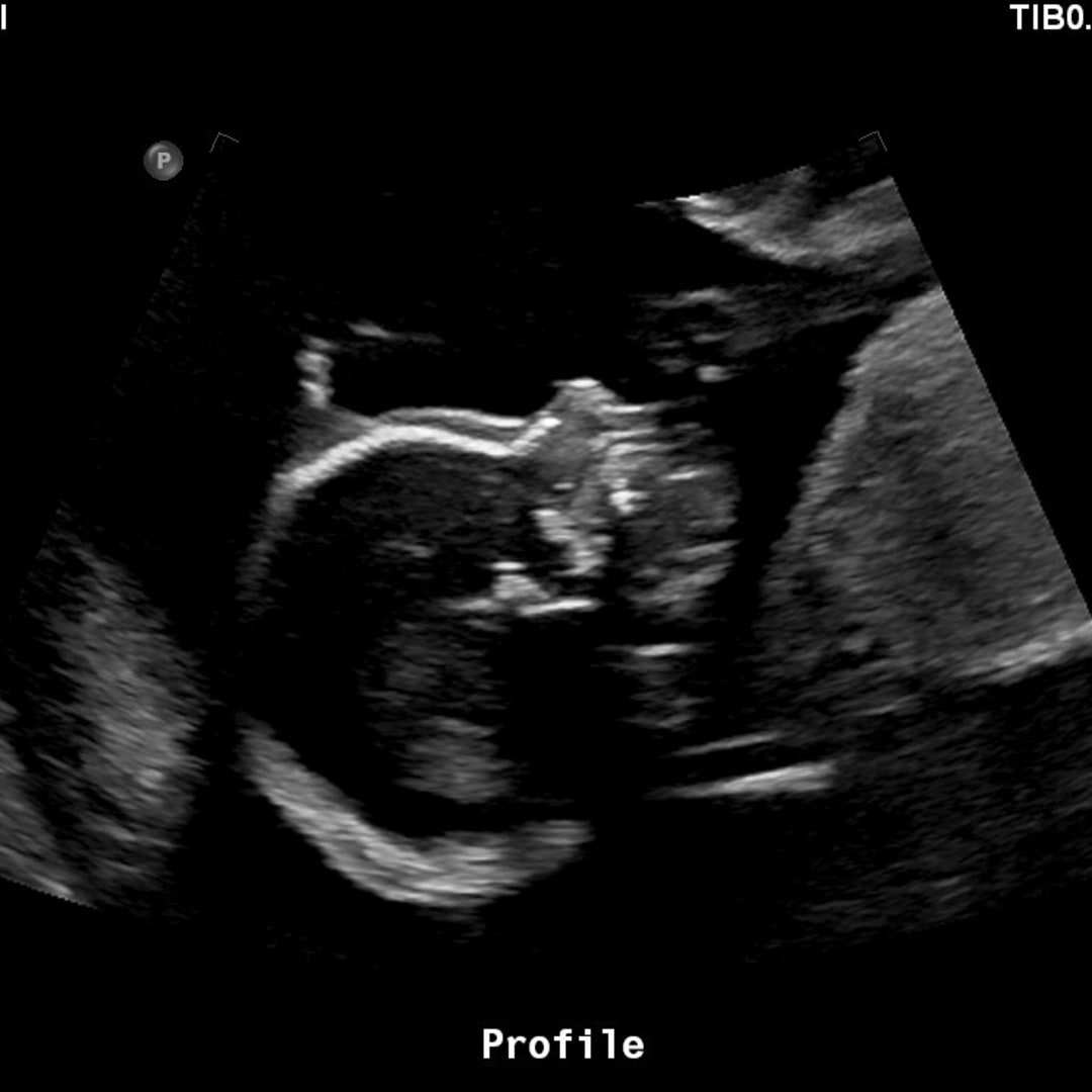 Photo shared by Bailee for their Babylist baby registry.