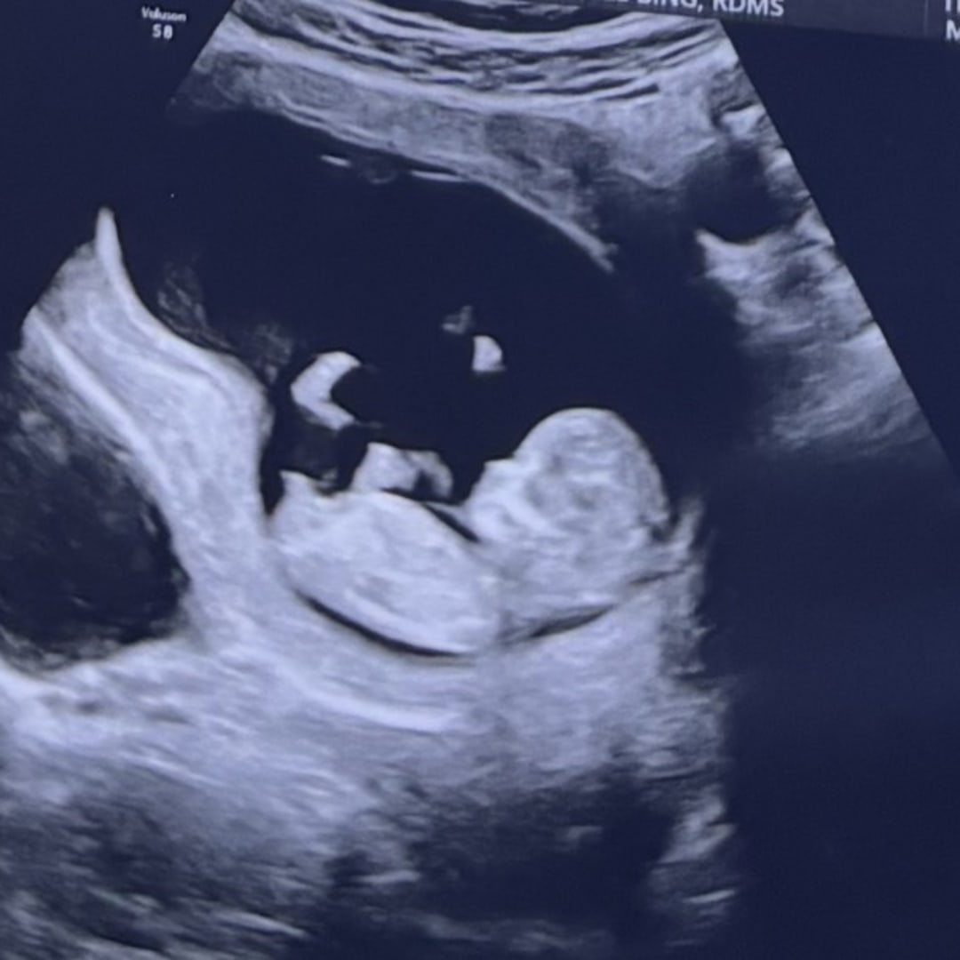 Photo shared by Kensleigh for their Babylist baby registry.