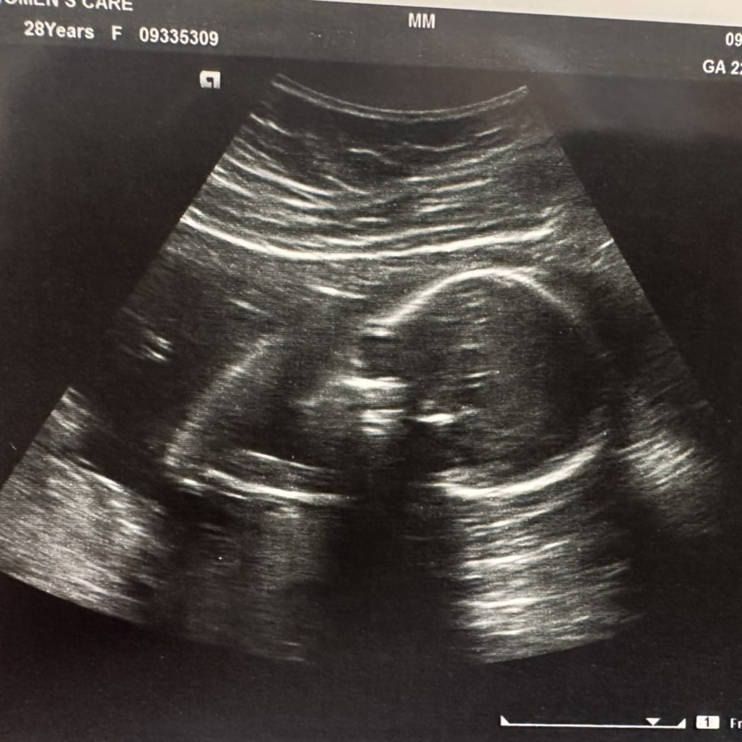 Photo shared by Brittani for their Babylist baby registry.
