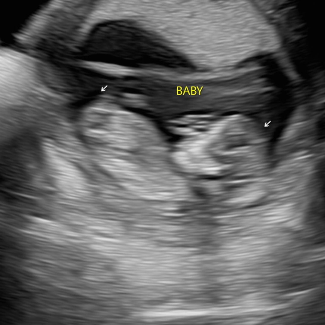 Photo shared by Anna for their Babylist baby registry.