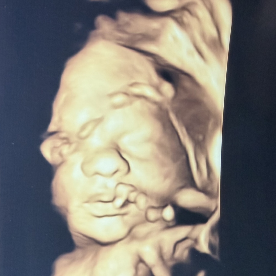 Photo shared by McKenna for their Babylist baby registry.