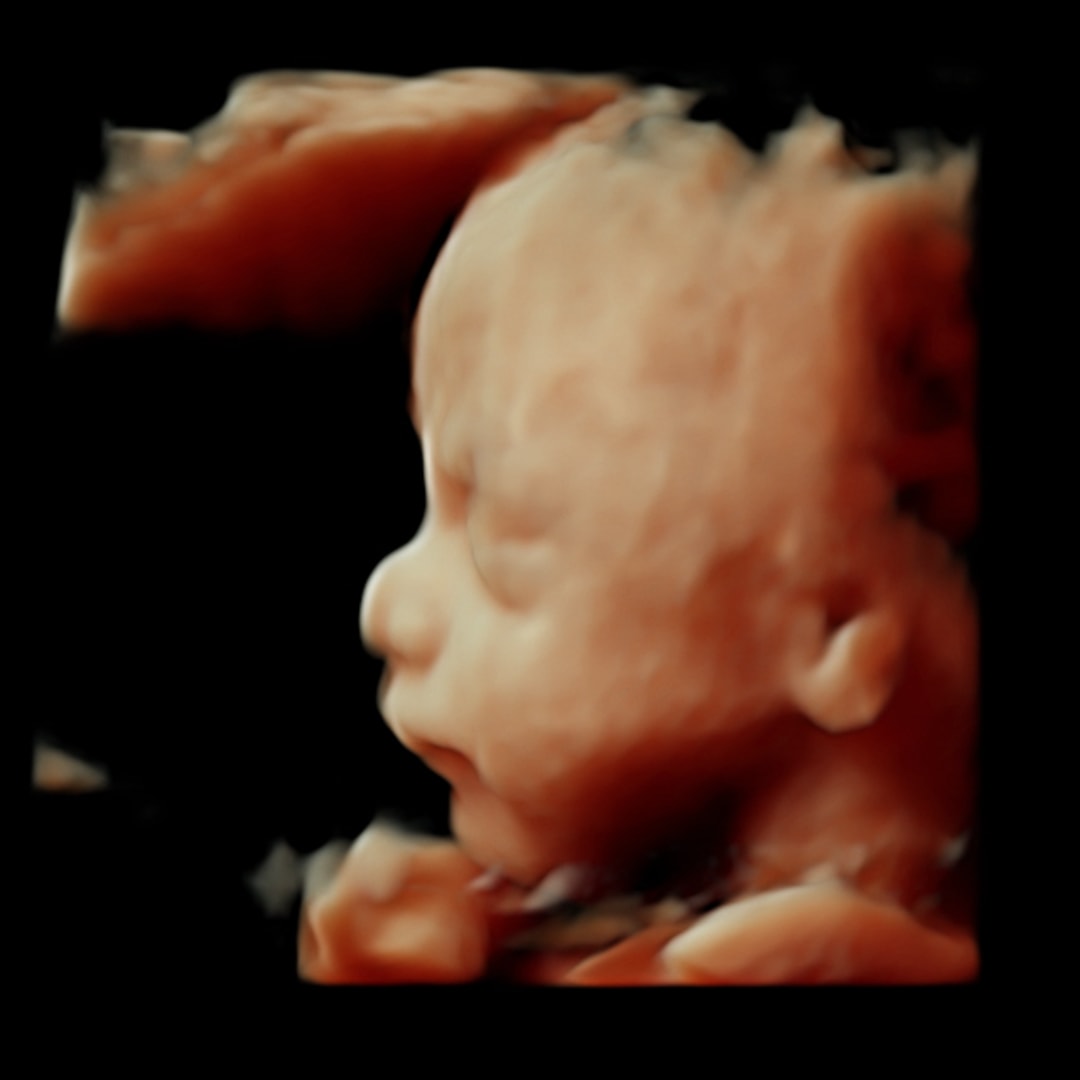 Photo shared by Lindsey for their Babylist baby registry.