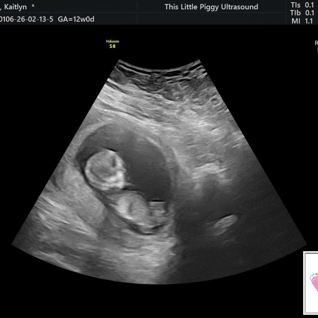 Photo shared by Kaitlyn for their Babylist baby registry.