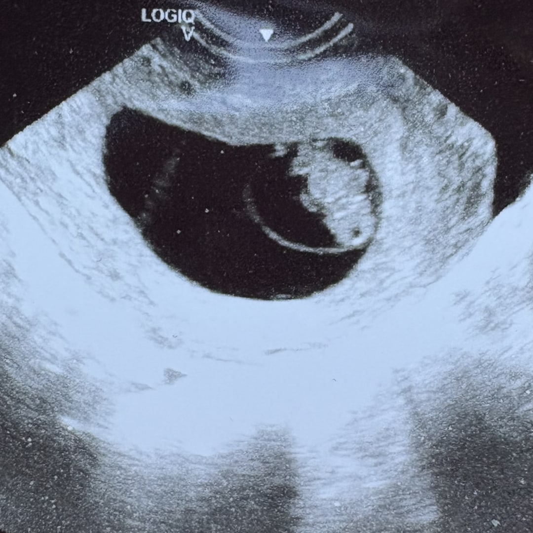 Photo shared by Chloe for their Babylist baby registry.