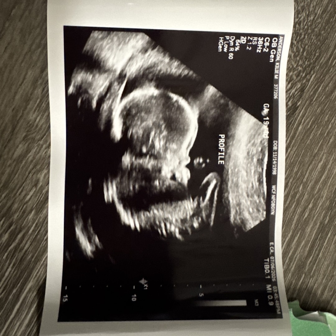 Photo shared by Kilie for their Babylist baby registry.