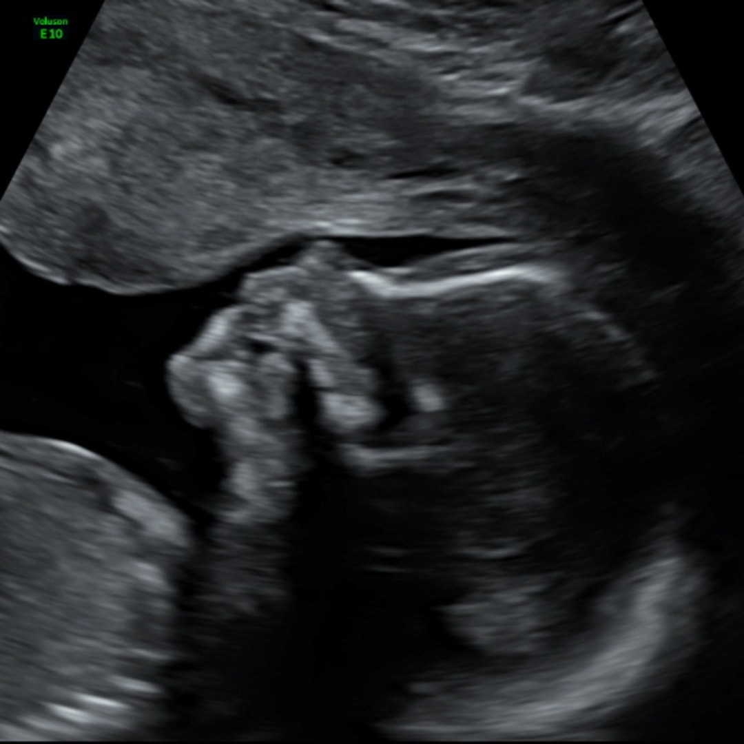 Photo shared by Julissa for their Babylist baby registry.