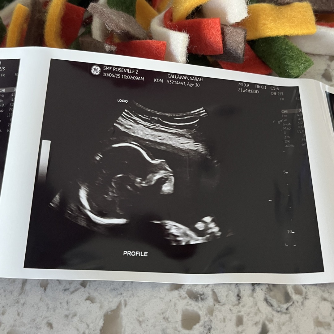 Photo shared by Sarah for their Babylist baby registry.