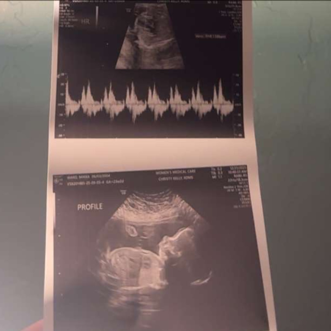 Photo shared by Mikka for their Babylist baby registry.