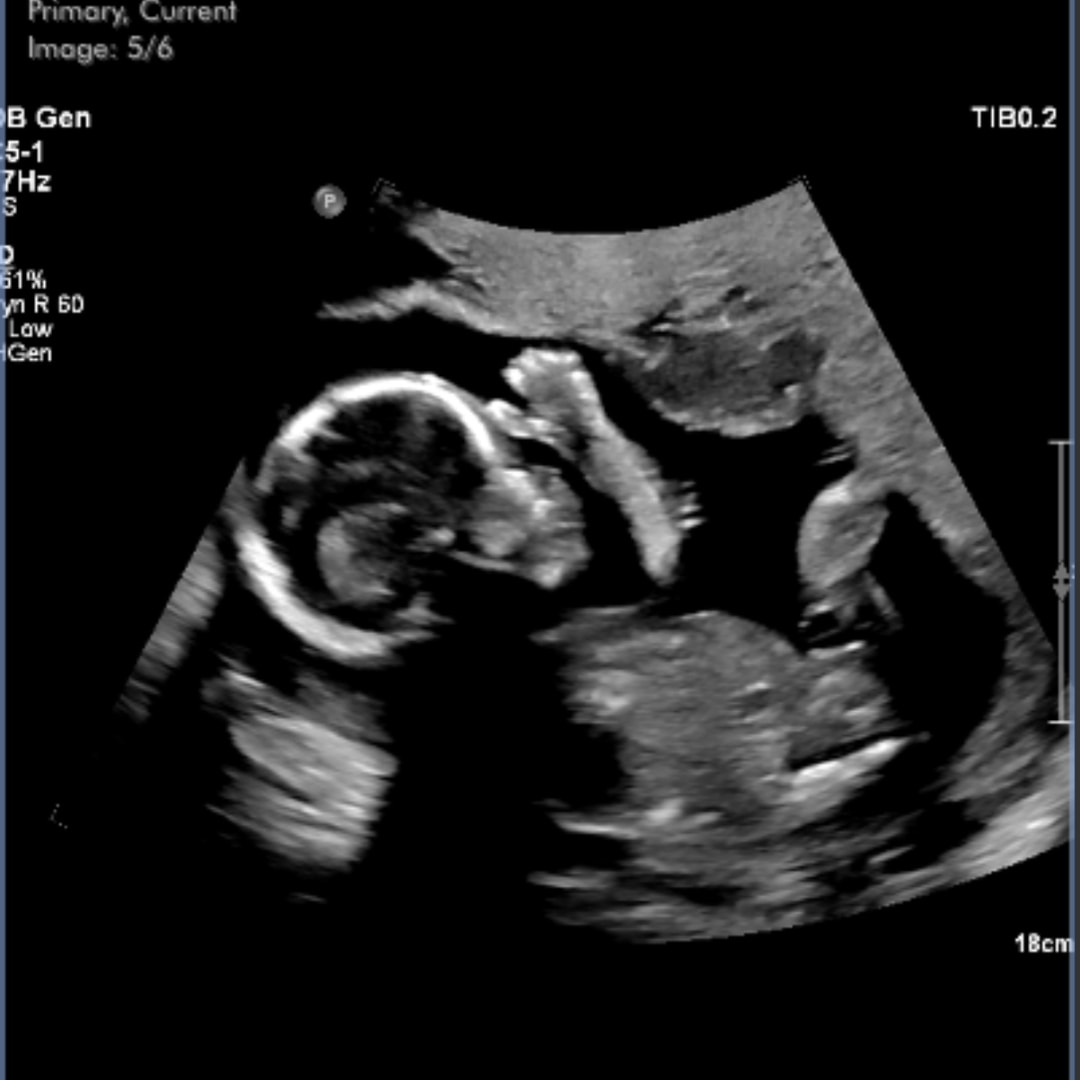 Photo shared by Kalina for their Babylist baby registry.