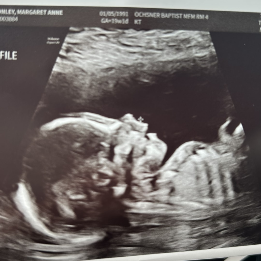Photo shared by Maggie for their Babylist baby registry.