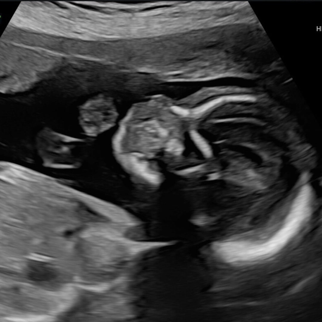 Photo shared by Ashley for their Babylist baby registry.