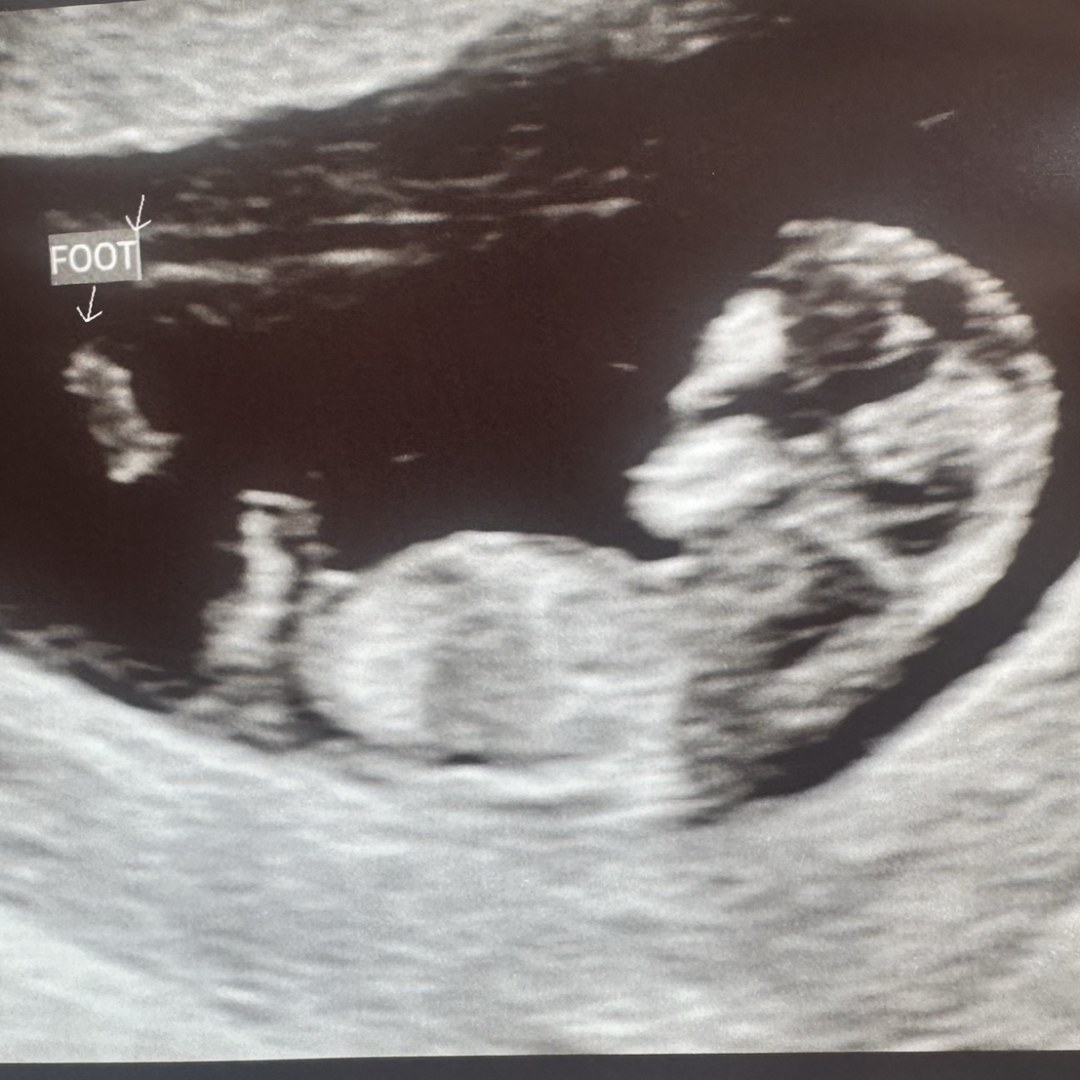 Photo shared by Sarah for their Babylist baby registry.