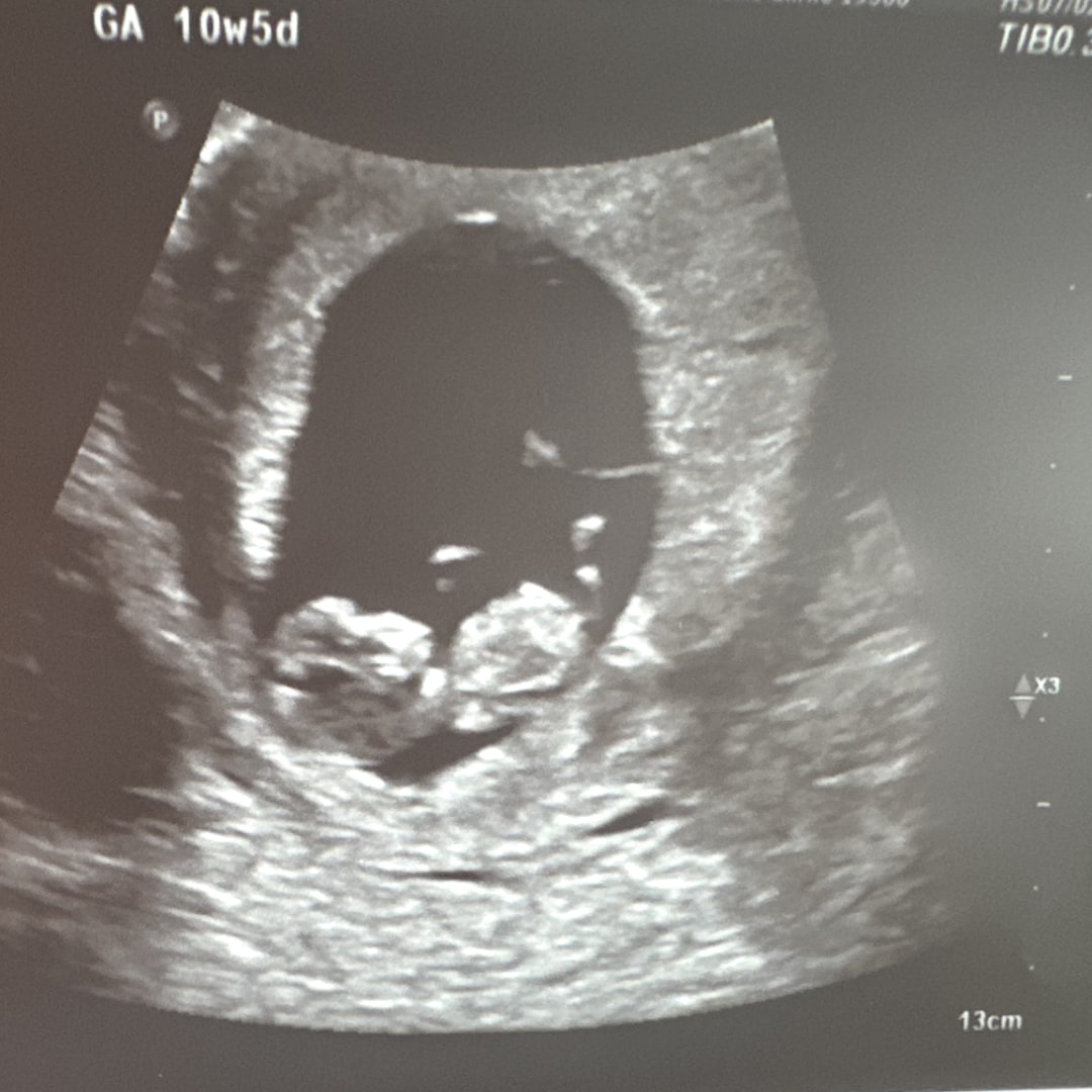 Photo shared by Corey for their Babylist baby registry.