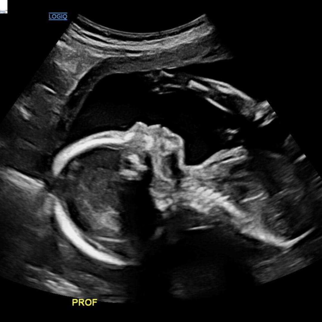 Photo shared by Destinee for their Babylist baby registry.