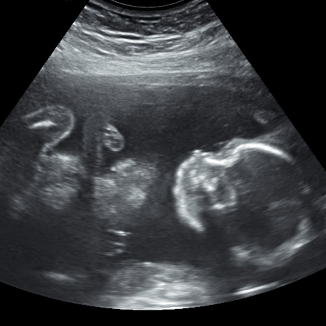 Photo shared by Alexis for their Babylist baby registry.
