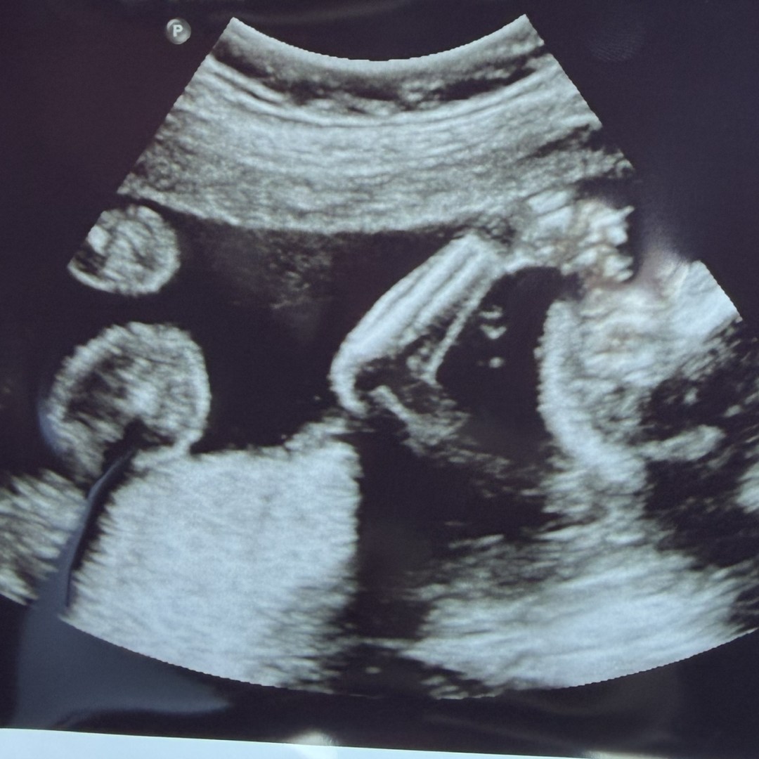 Photo shared by Kimberli for their Babylist baby registry.