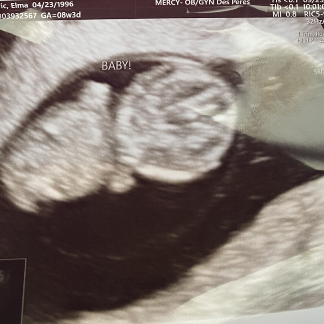 Photo shared by Elma for their Babylist baby registry.