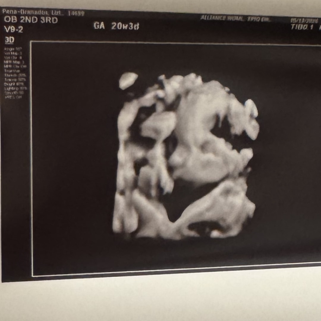 Photo shared by Lizbeth for their Babylist baby registry.