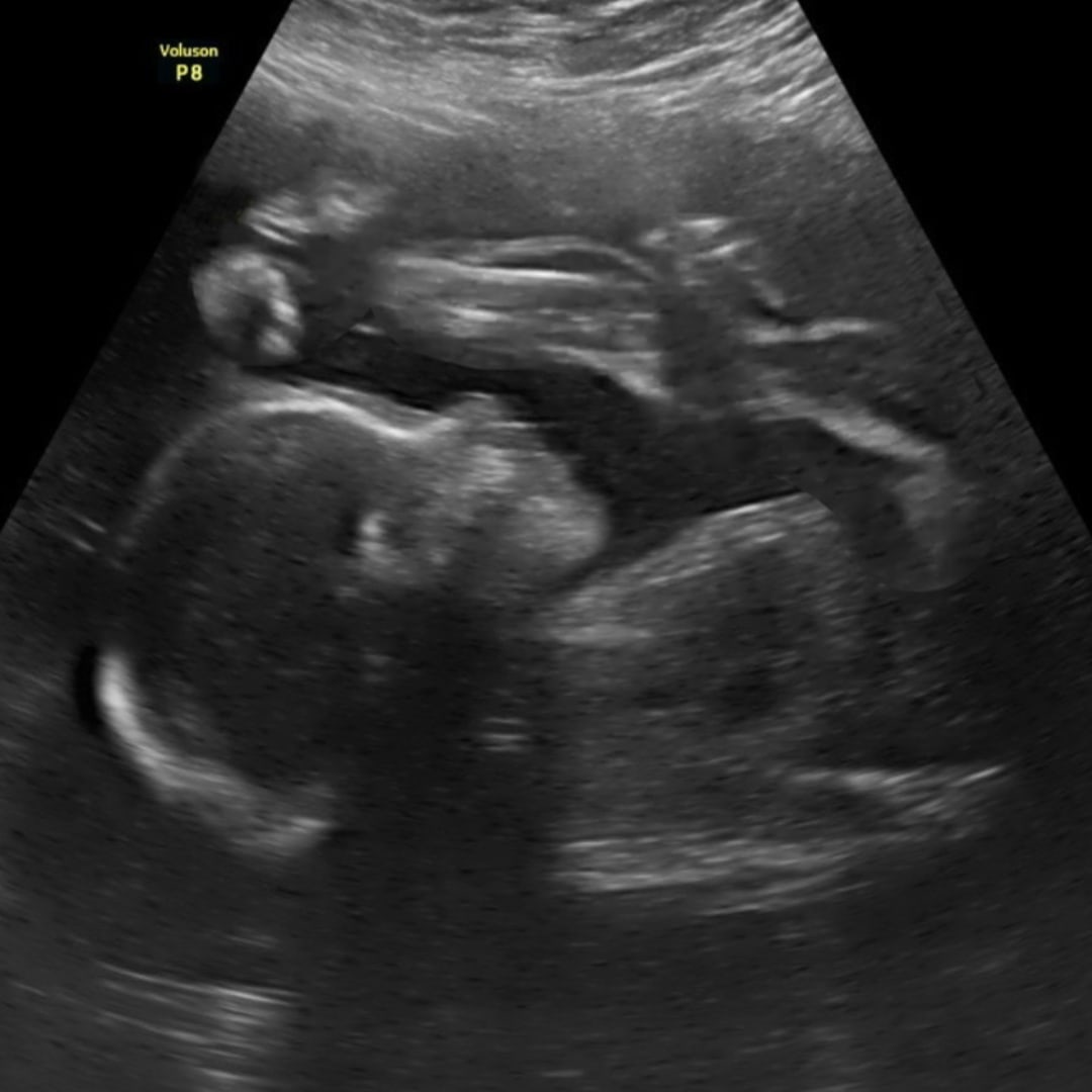 Photo shared by Nyhra for their Babylist baby registry.