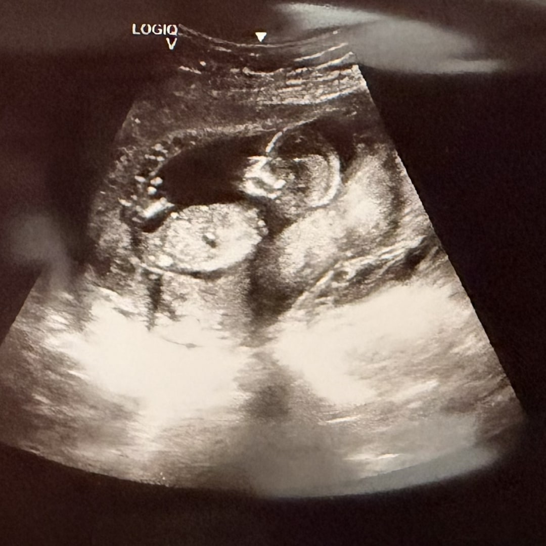 Photo shared by Crystal for their Babylist baby registry.