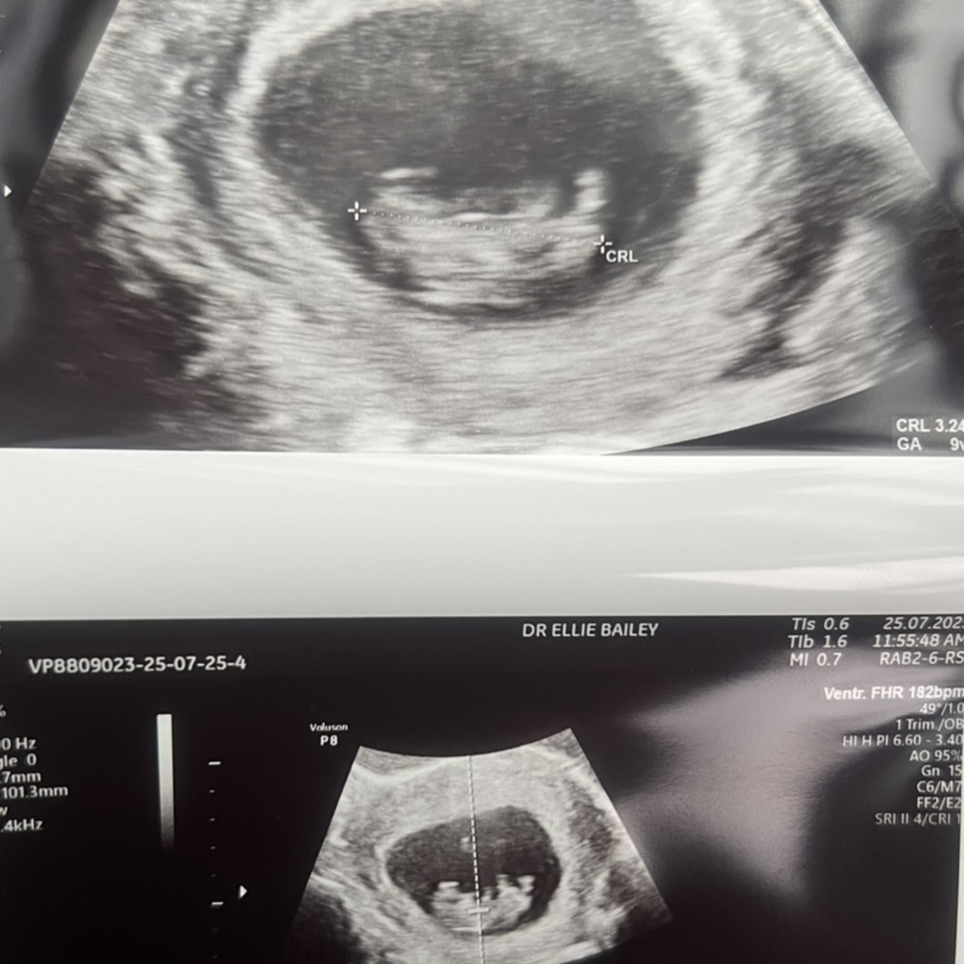 Photo shared by Lisa for their Babylist baby registry.