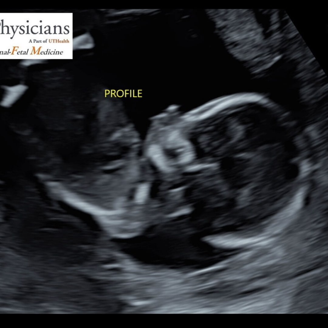Photo shared by Marilyn for their Babylist baby registry.