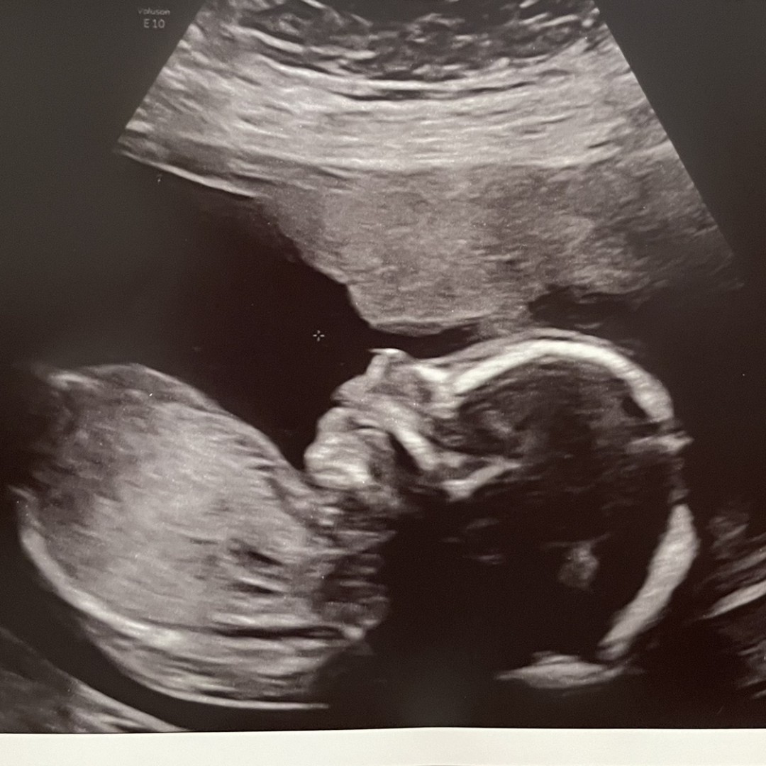 Photo shared by Erin for their Babylist baby registry.