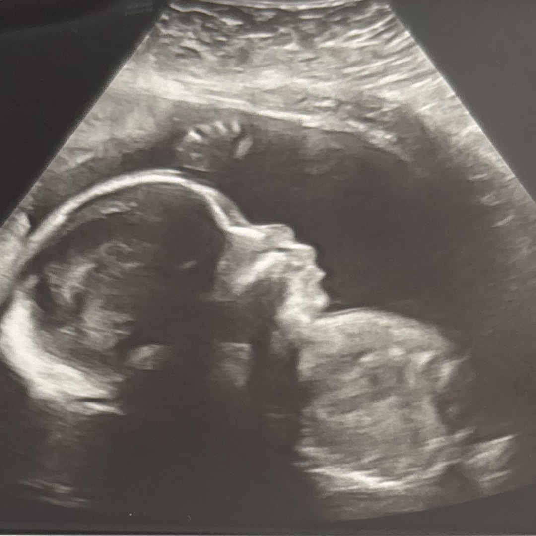 Photo shared by Grace for their Babylist baby registry.