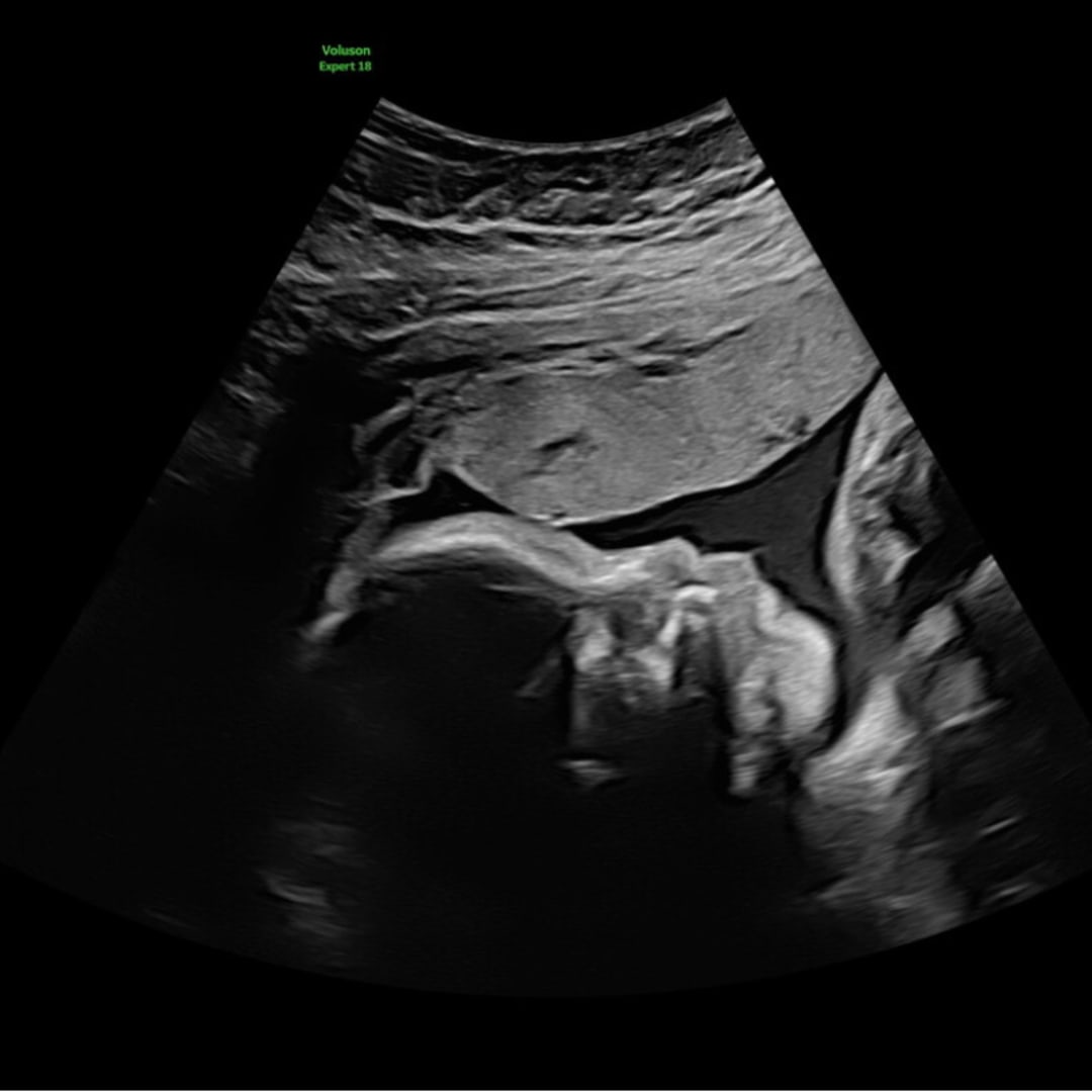 Photo shared by Theresa for their Babylist baby registry.