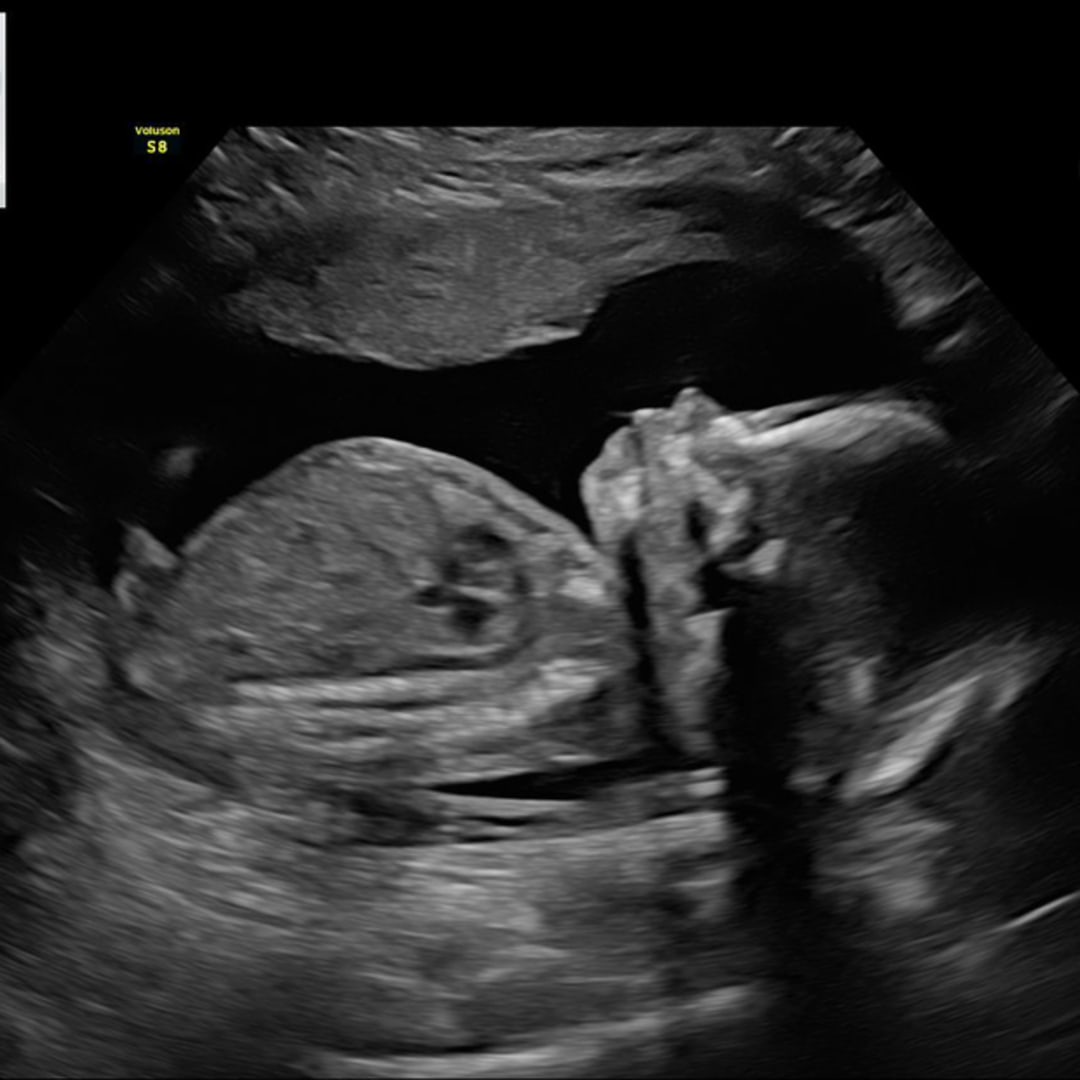 Photo shared by Lacey for their Babylist baby registry.