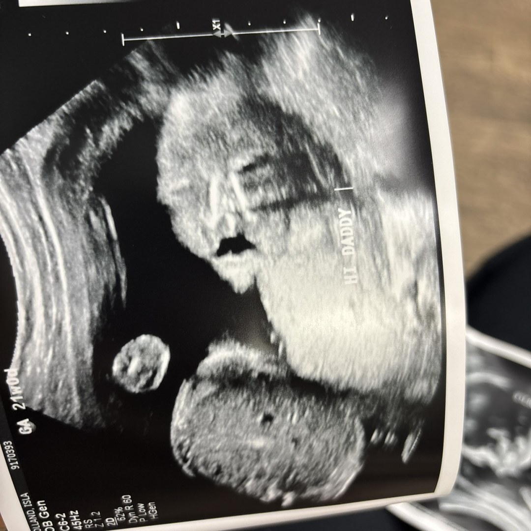 Photo shared by Isla for their Babylist baby registry.
