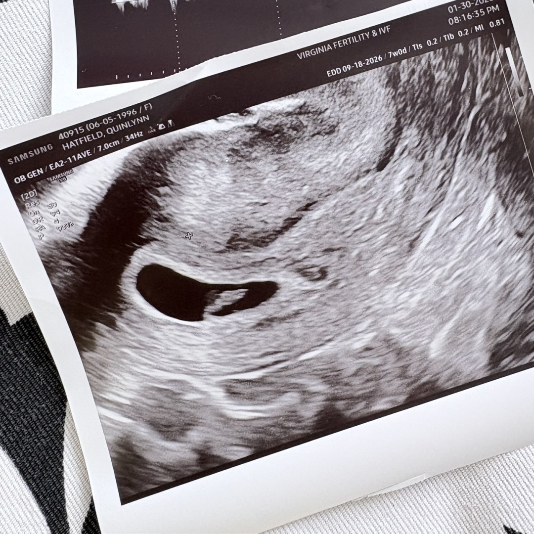 Photo shared by Quinlynn for their Babylist baby registry.
